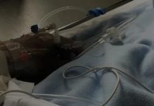 U plagos gjatë atentatit në Shkodër/ Familja e kamarieres 25-vjeçare apel për ndihmë
